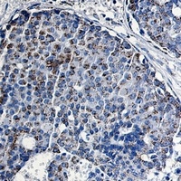 TCF6 Rabbit Monoclonal Antibody