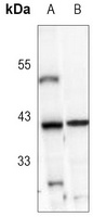 IKB alpha Rabbit Monoclonal Antibody