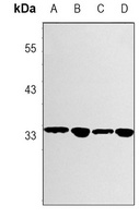 GNB2 Rabbit Monoclonal Antibody