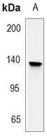 E Cadherin Rabbit Monoclonal Antibody