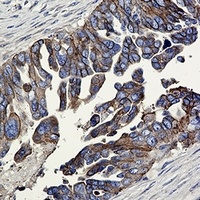 E Cadherin Rabbit Monoclonal Antibody