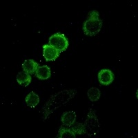 E Cadherin Rabbit Monoclonal Antibody