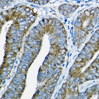 Nesprin 1 Rabbit Polyclonal Antibody