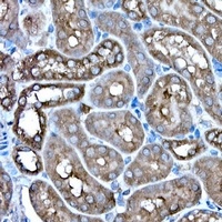 IRE1 Rabbit Polyclonal Antibody