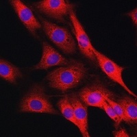 IRE1 Rabbit Polyclonal Antibody