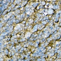 CD54 Rabbit Polyclonal Antibody