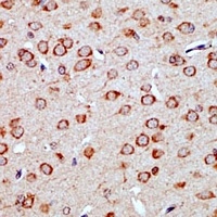 YAP1 Rabbit Polyclonal Antibody