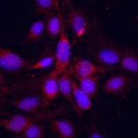 YAP1 Rabbit Polyclonal Antibody