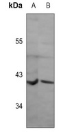 GPR136 Rabbit Polyclonal Antibody