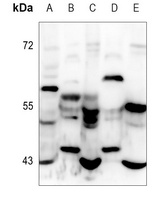 CCR10 Rabbit Polyclonal Antibody