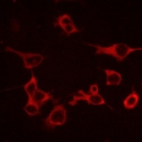 CCR10 Rabbit Polyclonal Antibody