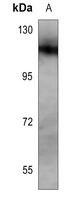 NOTCH1 Rabbit Polyclonal Antibody