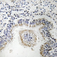 PI-TP alpha Rabbit Polyclonal Antibody