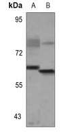 NCOA5 Rabbit Polyclonal Antibody