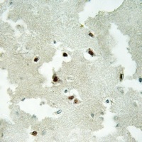 NCOA5 Rabbit Polyclonal Antibody