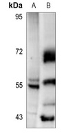 Fibulin 3 Rabbit Polyclonal Antibody