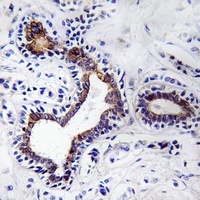 Fibulin 3 Rabbit Polyclonal Antibody