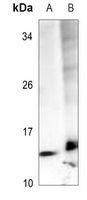 BRP44 Rabbit Polyclonal Antibody