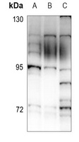 ALS2CR8 Rabbit Polyclonal Antibody