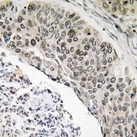 ALS2CR8 Rabbit Polyclonal Antibody