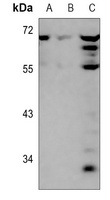 ARFGAP3 Rabbit Polyclonal Antibody
