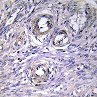 ABHD12 Rabbit Polyclonal Antibody