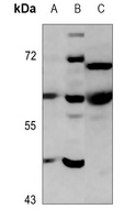PARP2 Rabbit Polyclonal Antibody
