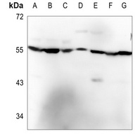 CDKAL1 Rabbit Polyclonal Antibody