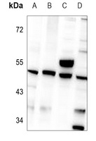 Zhangfei Rabbit Polyclonal Antibody