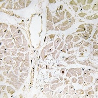 Zhangfei Rabbit Polyclonal Antibody