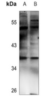 NT5C3 Rabbit Polyclonal Antibody