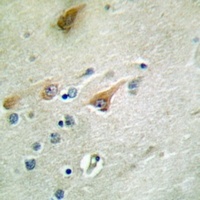 NT5C3 Rabbit Polyclonal Antibody