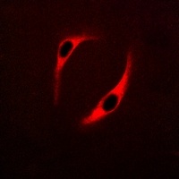 NT5C3 Rabbit Polyclonal Antibody