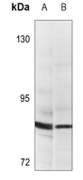 PGBD1 Rabbit Polyclonal Antibody