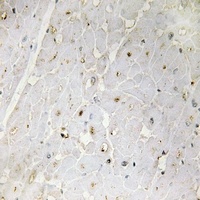 PGBD1 Rabbit Polyclonal Antibody