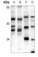 DOK4 Rabbit Polyclonal Antibody