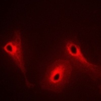 DOK4 Rabbit Polyclonal Antibody
