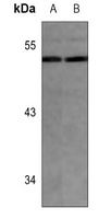 MLKL Rabbit Polyclonal Antibody