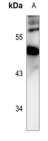 PRAK (Phospho-T182) Antibody