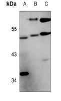 FOXO4 (Phospho-S262) Antibody