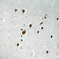 FOXO4 (Phospho-S262) Antibody