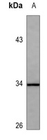 CDK2 (Phospho-T160) Antibody