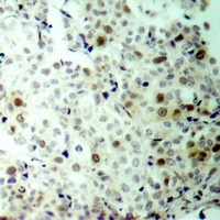 CDK2 (Phospho-T160) Antibody