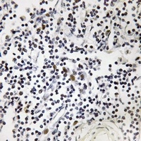 OCT1 (Phospho-S385) Antibody