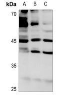 ROMK1 (Phospho-S44) Antibody