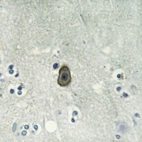 ROMK1 (Phospho-S44) Antibody
