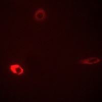 ROMK1 (Phospho-S44) Antibody