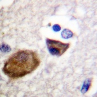 Kir5.1 (Phospho-S416) Antibody