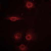 CD129 (Phospho-S519) Antibody