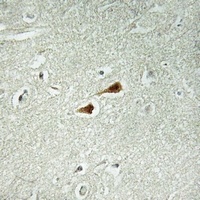 JIP1 (Phospho-T103) Antibody